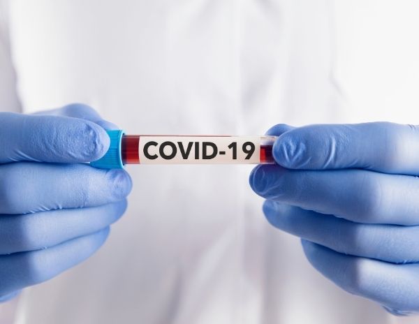 COVİD-19 Antikor Testi